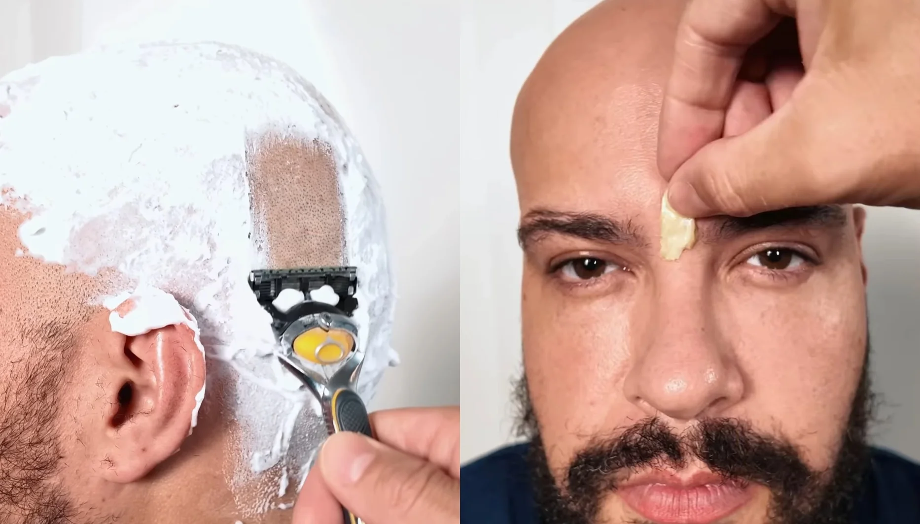 Uma imagem de tela dividida mostrando duas close-ups de um homem. A imagem da esquerda mostra um homem raspando a cabeça com um barbeador de lâmina e espuma de barbear. A imagem da direita mostra um homem removendo uma fita adesiva amarela do meio da testa.